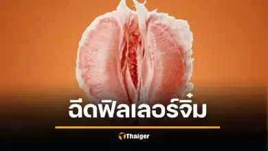 สวยสยอง! ฉีดฟิลเลอร์ช่องคลอด ดับ 2 ศพ อุดตันหลอดเลือดที่ปอด