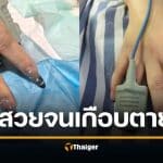 สาวเกือบตายเพราะต่อเล็บเจล หัวใจหยุดเต้น เครื่องวัดออกซิเจนไม่ได้ ต้องเรียกช่างทำเล็บเข้าห้องฉุกเฉิน