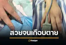 สาวเกือบตายเพราะต่อเล็บเจล หัวใจหยุดเต้น เครื่องวัดออกซิเจนไม่ได้ ต้องเรียกช่างทำเล็บเข้าห้องฉุกเฉิน