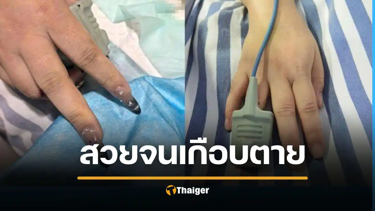 สาวเกือบตายเพราะต่อเล็บเจล หัวใจหยุดเต้น เครื่องวัดออกซิเจนไม่ได้ ต้องเรียกช่างทำเล็บเข้าห้องฉุกเฉิน