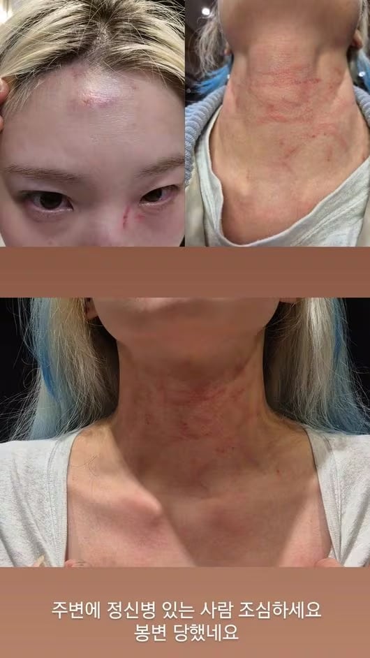 ช็อก! ไอดอลสาวเกาหลี ถูกทำร้ายร่างกาย ได้รับบาดเจ็บ ค่ายยกระดับดูแลศิลปินเข้มงวดขึ้น-1