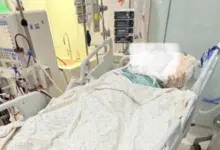 สรุปดราม่า ทำจมูกไม่ฟื้นเข้า ICU หมอเจ้าของไข้แจงอีกมุม สาเหตุคนไข้ช็อก