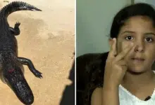 ดญ. 10 ขวบฟลอริดา รอดตายจระเข้ กัดขา ไหวพริบเอานิ้วอุดจมูก