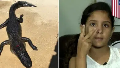 ดญ. 10 ขวบฟลอริดา รอดตายจระเข้ กัดขา ไหวพริบเอานิ้วอุดจมูก