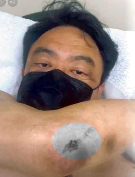 หวิดสิ้นชื่อ รอง ผอ.เทศกิจ เล่านาทีถูก ตุ๊กตุ๊กเฉี่ยวชน ขณะข้ามทางม้าลาย แยกพลับพลาไชย-3