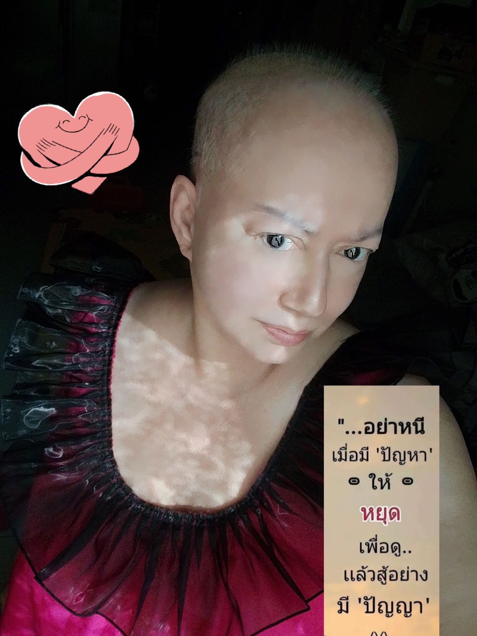 แหม่ม ลิษา เผยภาพอาการล่าสุด หลังรักษามะเร็งปอด เผย กำลังใจเกินร้อย สู้ไม่ถอยในทุกวัน-2