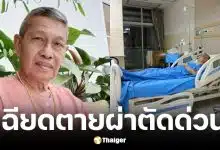 ชาลี คดีเด็ด ผังผืดเกาะลำไส้ ผ่าตัดด่วน