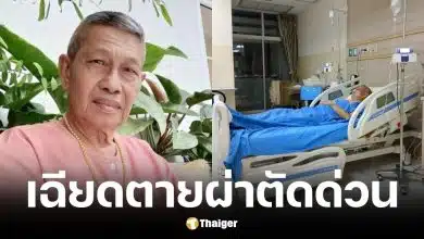 ชาลี คดีเด็ด ผังผืดเกาะลำไส้ ผ่าตัดด่วน