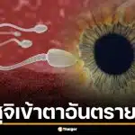 น้ำอสุจิเข้าตา อันตรายไหม? หมอตาไต้หวันเฉลยละเอียด