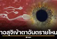 น้ำอสุจิเข้าตา อันตรายไหม? หมอตาไต้หวันเฉลยละเอียด