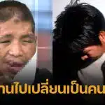 ภาพล่าสุด น้องฟ้า เหยื่อนายจ้างโหด หลังผ่านศัลยกรรม 4 ปี หนุ่ม กรรชัย ร่วมยินดีชีวิตใหม่