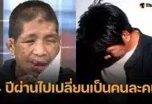 ภาพล่าสุด น้องฟ้า เหยื่อนายจ้างโหด หลังผ่านศัลยกรรม 4 ปี หนุ่ม กรรชัย ร่วมยินดีชีวิตใหม่