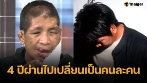 ภาพล่าสุด น้องฟ้า เหยื่อนายจ้างโหด หลังผ่านศัลยกรรม 4 ปี หนุ่ม กรรชัย ร่วมยินดีชีวิตใหม่