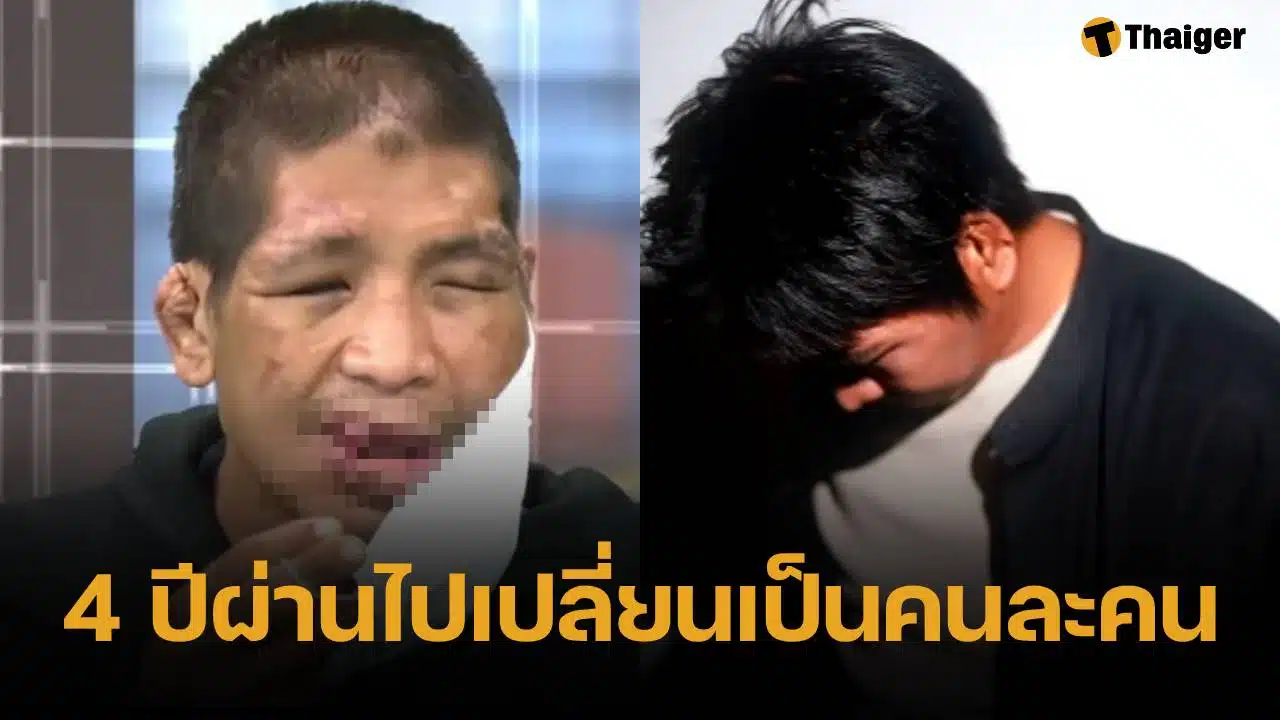 ภาพล่าสุด น้องฟ้า เหยื่อนายจ้างโหด หลังผ่านศัลยกรรม 4 ปี หนุ่ม กรรชัย ร่วมยินดีชีวิตใหม่