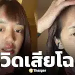 พลอย Pigkaploy หน้าเป็นแผลเหวอะ หลังจบทริปแอนตาร์กติกา ทำแฟนๆ ห่วงหนัก