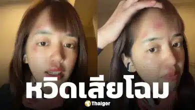 พลอย Pigkaploy หน้าเป็นแผลเหวอะ หลังจบทริปแอนตาร์กติกา ทำแฟนๆ ห่วงหนัก