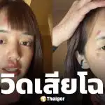 พลอย Pigkaploy หน้าเป็นแผลเหวอะ หลังจบทริปแอนตาร์กติกา ทำแฟนๆ ห่วงหนัก