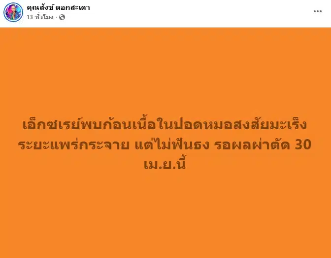 สังข์ ดอกสะเดา อัปเดตอาการป่วย-2
