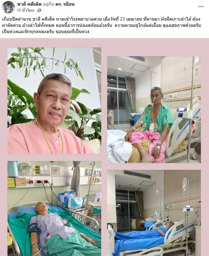 ชาลี คดีเด็ด ผังผืดเกาะลำไส้ ต้องผ่าตัดด่วน