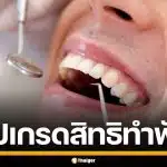 ประกันสังคม อัปเกรดสิทธิทำฟัน-ปรับวงเงิน รพ.รัฐ ฟรีไม่จำกัดครั้ง เริ่ม 1 พ.ค. นี้