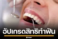 ประกันสังคม อัปเกรดสิทธิทำฟัน-ปรับวงเงิน รพ.รัฐ ฟรีไม่จำกัดครั้ง เริ่ม 1 พ.ค. นี้