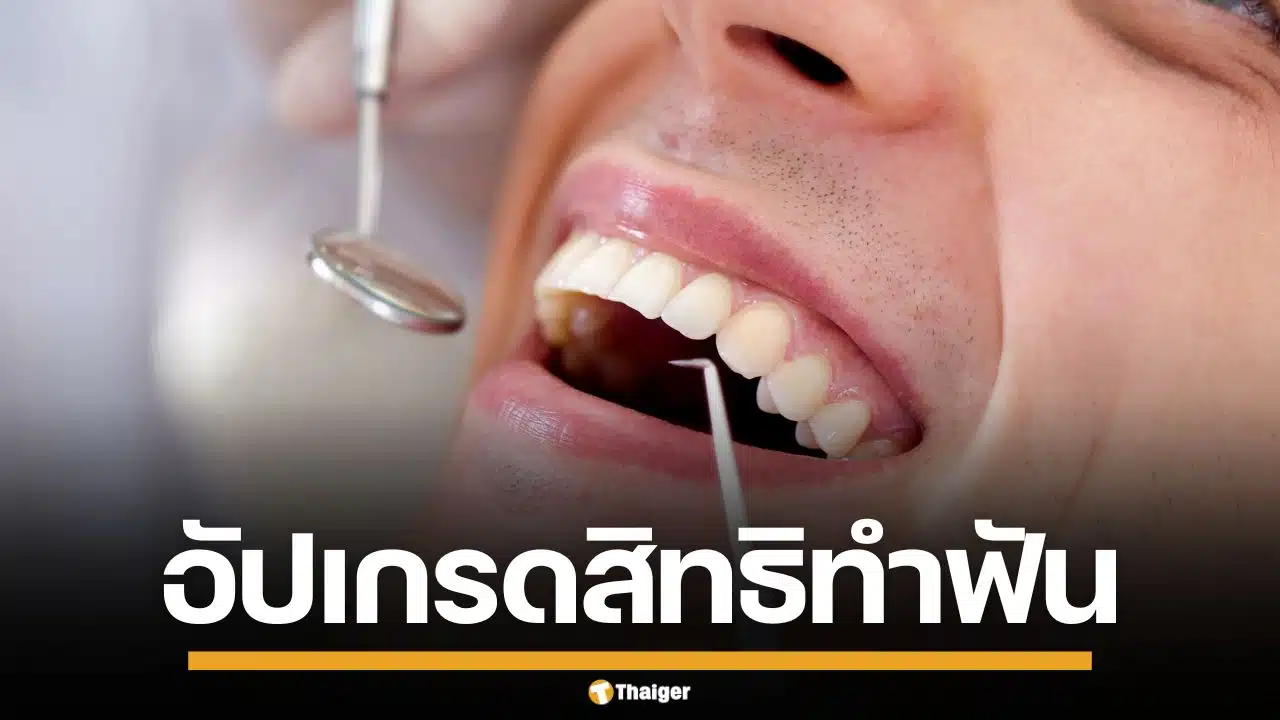 ประกันสังคม อัปเกรดสิทธิทำฟัน-ปรับวงเงิน รพ.รัฐ ฟรีไม่จำกัดครั้ง เริ่ม 1 พ.ค. นี้