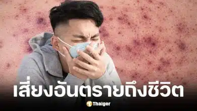 สสส. เตือนโรคไข้กาฬหลังแอ่นรุนแรงถึงขั้นเสียชีวิตได้ใน 24 ชม.