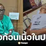 สังข์ ดอกสะเดา อัปเดตอาการป่วยหลังพบก้อนเนื้อในปอด