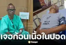 สังข์ ดอกสะเดา อัปเดตอาการป่วยหลังพบก้อนเนื้อในปอด