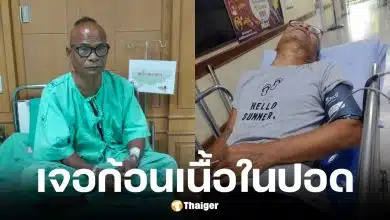 สังข์ ดอกสะเดา อัปเดตอาการป่วยหลังพบก้อนเนื้อในปอด