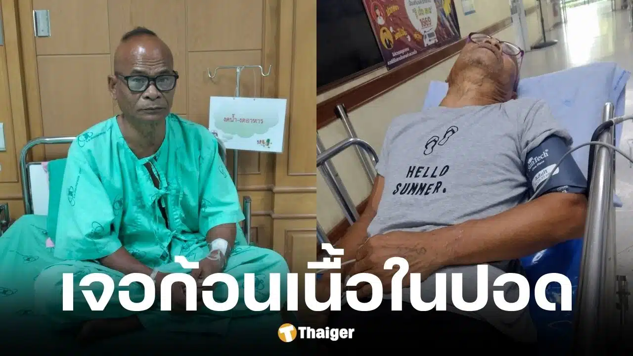 สังข์ ดอกสะเดา อัปเดตอาการป่วยหลังพบก้อนเนื้อในปอด