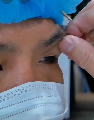 ภาพล่าสุด น้องฟ้า เหยื่อนายจ้างโหด หลังผ่านศัลยกรรม 4 ปี หนุ่ม กรรชัย ร่วมยินดีชีวิตใหม่-4