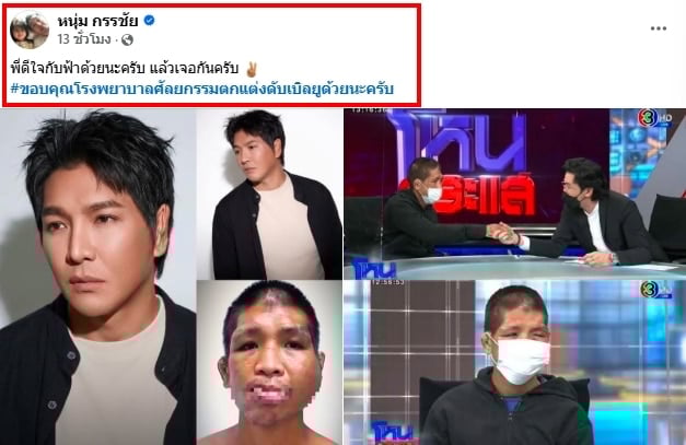 ภาพล่าสุด น้องฟ้า เหยื่อนายจ้างโหด หลังผ่านศัลยกรรม 4 ปี หนุ่ม กรรชัย ร่วมยินดีชีวิตใหม่-5