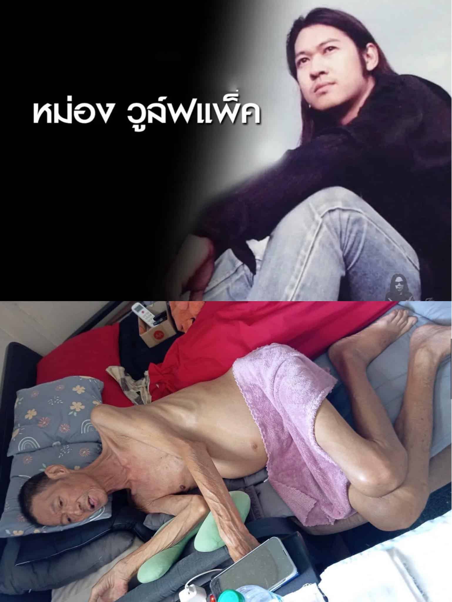 ระดมทุนช่วย มือเบสวงร็อคยุค 90 ป่วยตับแข็งระยะสุดท้าย-เสี่ยงมะเร็ง อาการน่าเป็นห่วง-2