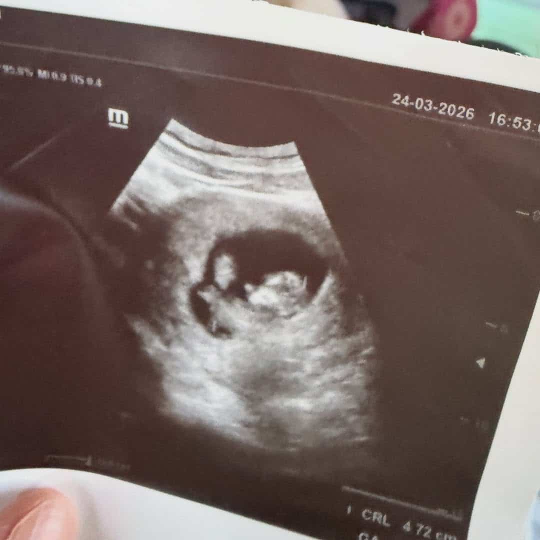 ร่วมยินดี พระเอกช่อง 7 ประกาศข่าวดี ภรรยาตั้งท้องลูกคนแรกแล้ว หลังแต่งงาน 2 ปี-4