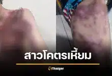 สาว 19 เหี้ยม สาดน้ำกรดแฟนเก่าเหวอะ ไม่ยอมคืนดี โพสต์เย้ย "อย่าเพิ่งตาย" พี่สาววอนขอความเป็นธรรมคดีไม่คืบ