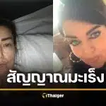 อย่ามองข้าม! แม่วัย 54 นึกว่าแค่อาการ "วัยทอง" สุดท้ายตรวจพบ "มะเร็งลำไส้"
