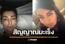 อย่ามองข้าม! แม่วัย 54 นึกว่าแค่อาการ "วัยทอง" สุดท้ายตรวจพบ "มะเร็งลำไส้"