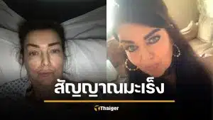 อย่ามองข้าม! แม่วัย 54 นึกว่าแค่อาการ "วัยทอง" สุดท้ายตรวจพบ "มะเร็งลำไส้"