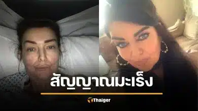 อย่ามองข้าม! แม่วัย 54 นึกว่าแค่อาการ "วัยทอง" สุดท้ายตรวจพบ "มะเร็งลำไส้"