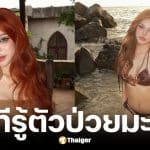 อินฟลูสาวเวียดนามวัย 23 ปีป่วยมะเร็งเม็ดเลือดขาว
