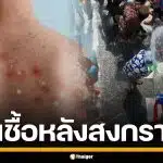 หนุ่มเวียดนาม วัย 23 อ้างติด HIV หลังเที่ยวสงกรานต์ไทย ปล่อยตัวมีเซ็กซ์ไม่ป้องกัน