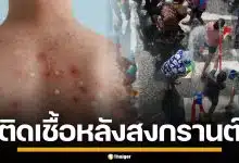 หนุ่มเวียดนาม วัย 23 อ้างติด HIV หลังเที่ยวสงกรานต์ไทย ปล่อยตัวมีเซ็กซ์ไม่ป้องกัน