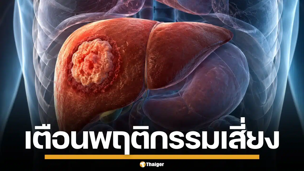 หมอแล็บแพนด้า เตือนพฤติกรรมเสี่ยง ไวรัสตับอักเสบบี ต้นเหตุ ตับแข็ง-มะเร็งตับ