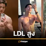 เจมส์จิ ฟิตปั๋ง กล้ามใหญ่ ยังไม่รอด LDL สูงปรี๊ด เพราะกรรมพันธุ์ ต้องกินยา