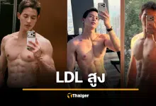 เจมส์จิ ฟิตปั๋ง กล้ามใหญ่ ยังไม่รอด LDL สูงปรี๊ด เพราะกรรมพันธุ์ ต้องกินยา