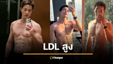 เจมส์จิ ฟิตปั๋ง กล้ามใหญ่ ยังไม่รอด LDL สูงปรี๊ด เพราะกรรมพันธุ์ ต้องกินยา