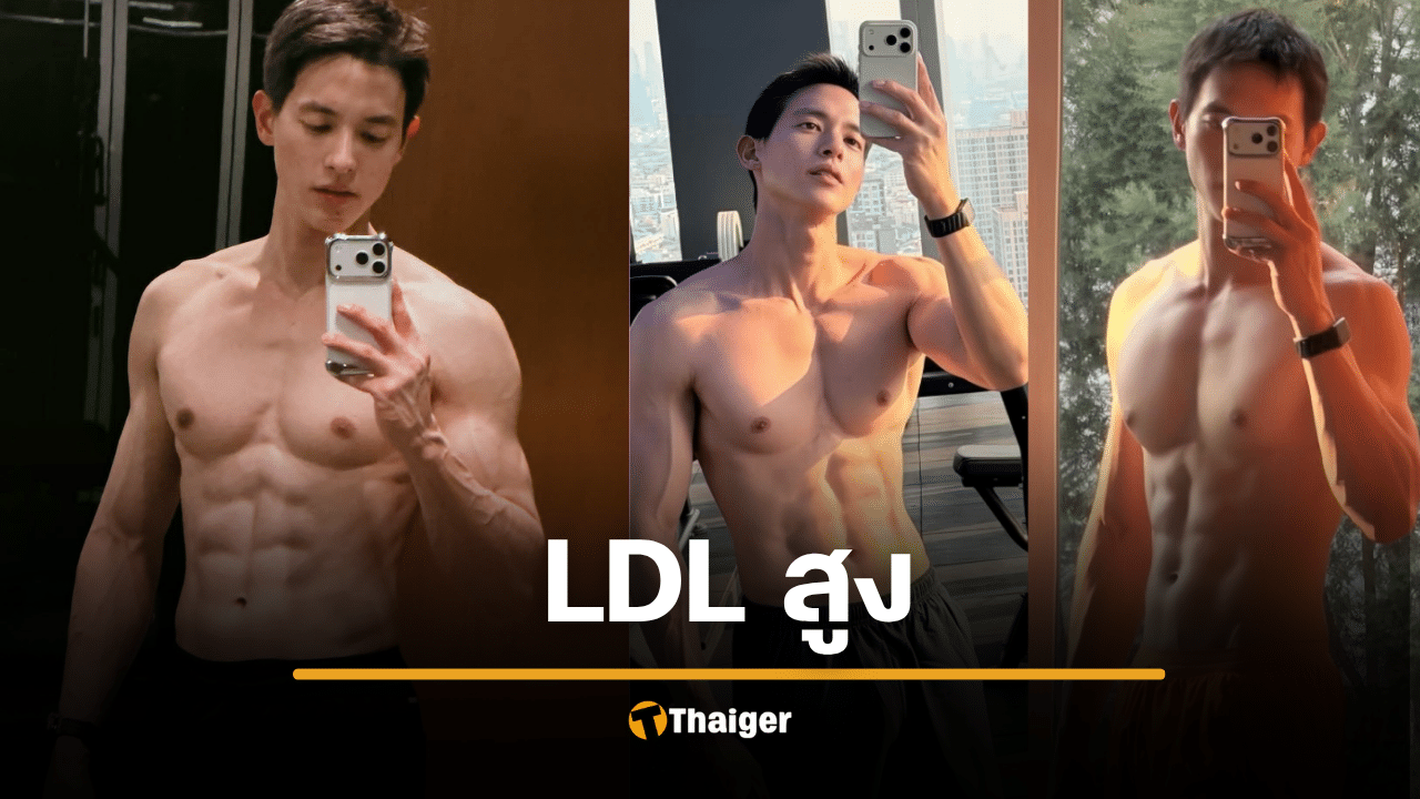เจมส์จิ ฟิตปั๋ง กล้ามใหญ่ ยังไม่รอด LDL สูงปรี๊ด เพราะกรรมพันธุ์ ต้องกินยา