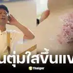 เสก โลโซ มีผื่นและตุ่มใสขึ้นแขน หวั่นเป็นงูสวัด