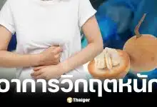 แม่กลืนเม็ดกระท้อนทำกระเพาะทะลุ ต้องตัดลำไส้ทิ้ง